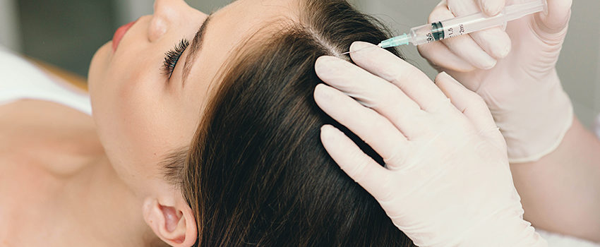 treatment of hair loss, injection for hair growth. Injected in woman's head, hair mesotherapy